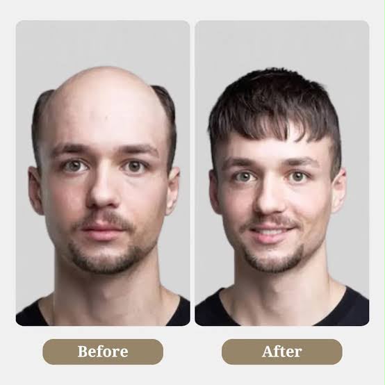 Hair Patch